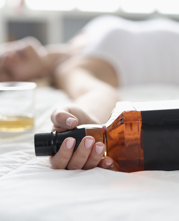 Alcoholic coma – Acute alcohol intoxication